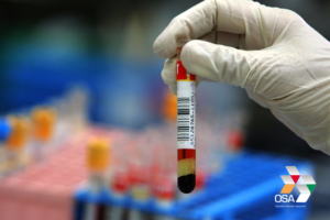 nws_alzheimer_un_esame_del_sangue_diagnosi_precoce_1735_1